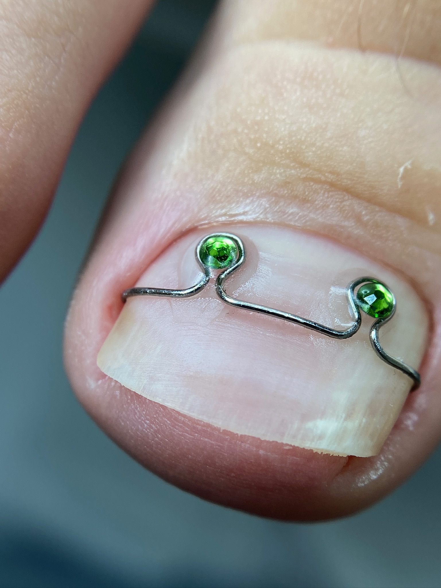 Corrective wire with green decorative attachments